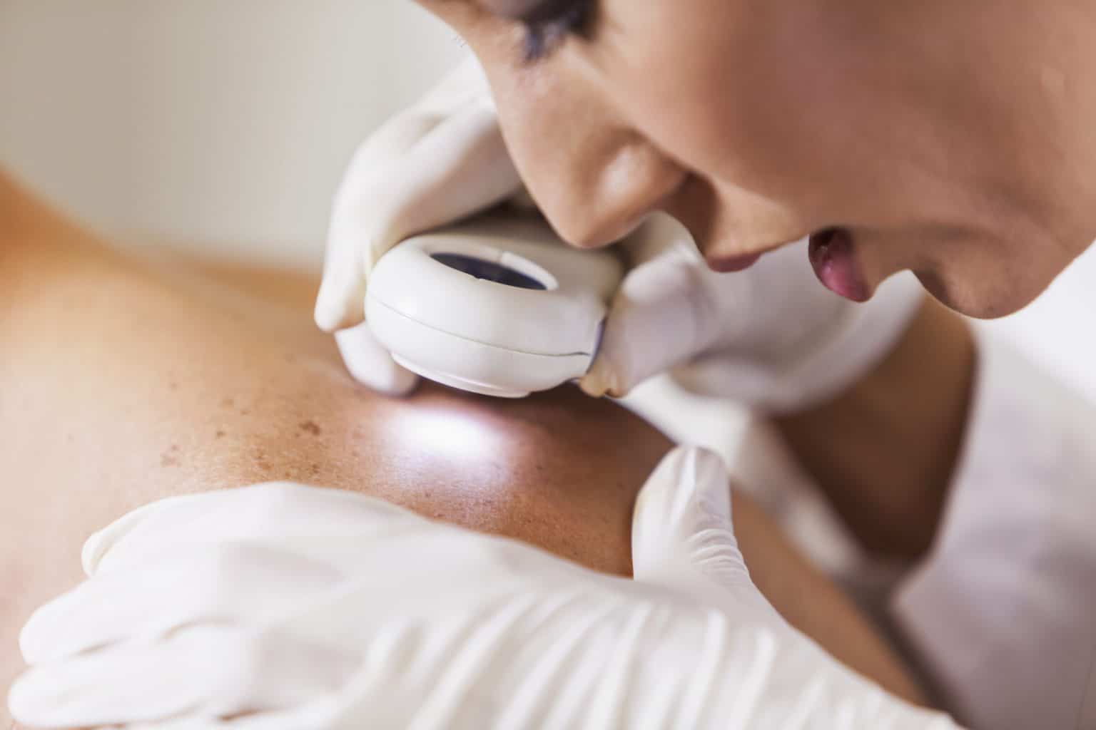 Physician looking at patient's skin for signs of skin cancer